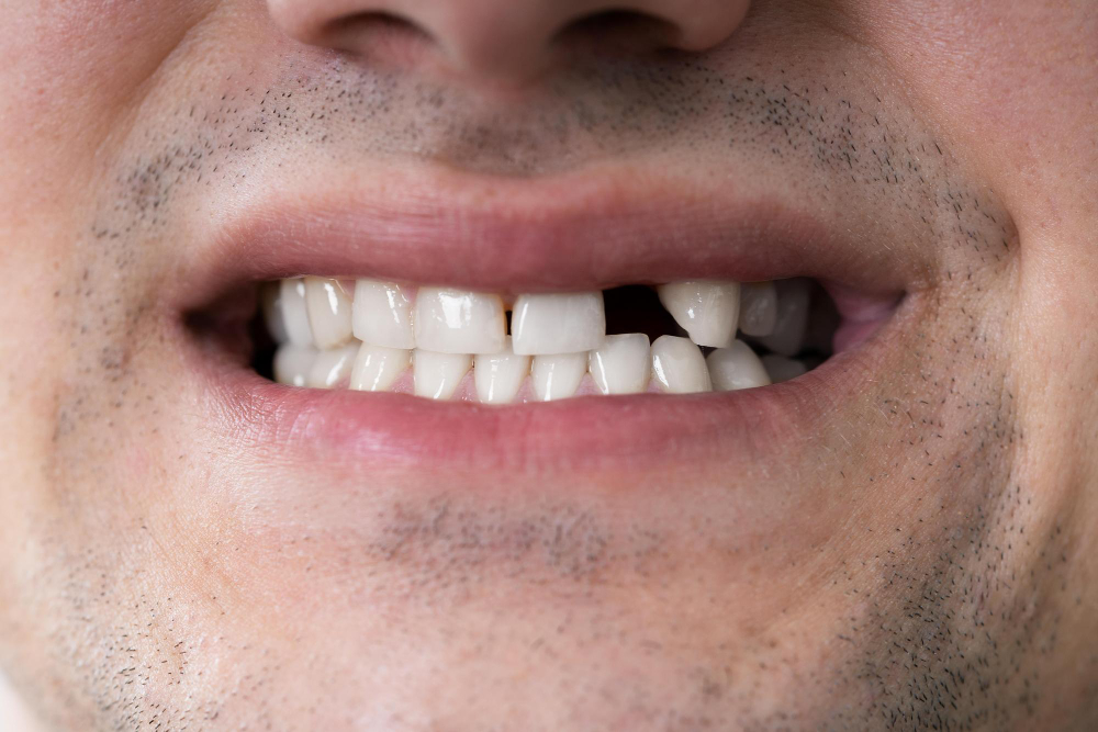 Traumatic Injuries